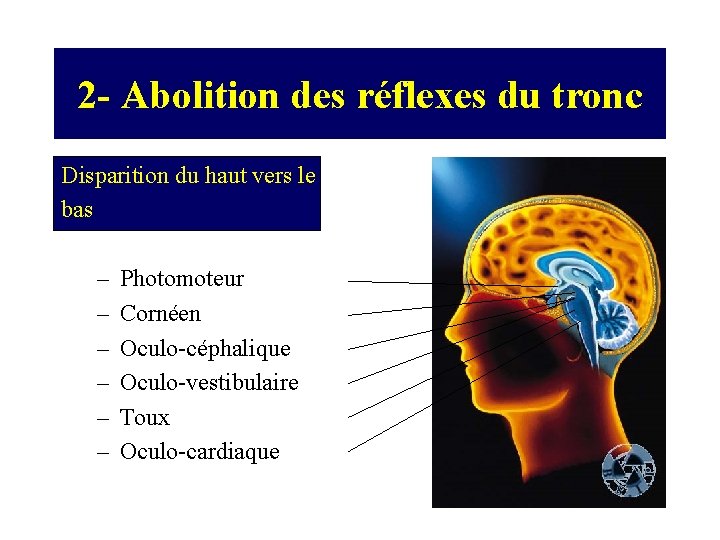 2 - Abolition des réflexes du tronc Disparition du haut vers le bas –