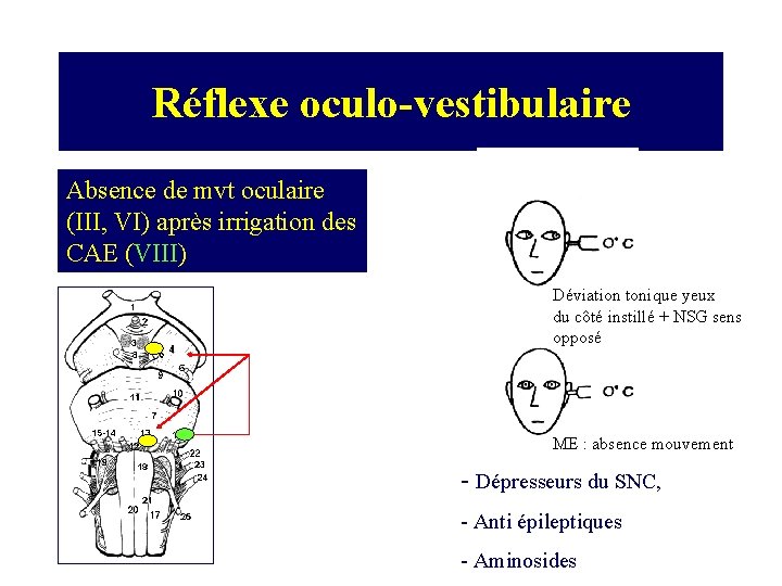 Réflexe oculo-vestibulaire Absence de mvt oculaire (III, VI) après irrigation des CAE (VIII) Déviation