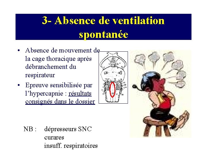 3 - Absence de ventilation spontanée • Absence de mouvement de la cage thoracique