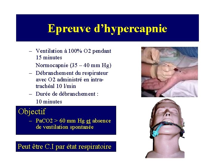 Epreuve d’hypercapnie – Ventilation à 100% O 2 pendant 15 minutes Normocapnie (35 –