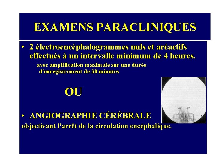 EXAMENS PARACLINIQUES • 2 électroencéphalogrammes nuls et aréactifs effectués à un intervalle minimum de