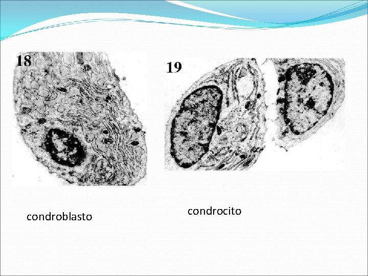 condroblasto condrocito 