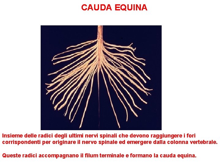 CAUDA EQUINA Insieme delle radici degli ultimi nervi spinali che devono raggiungere i fori