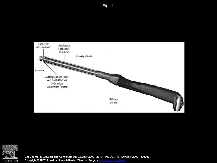 Fig. 1 The Journal of Thoracic and Cardiovascular Surgery 2002 123777 -782 DOI: (10.
