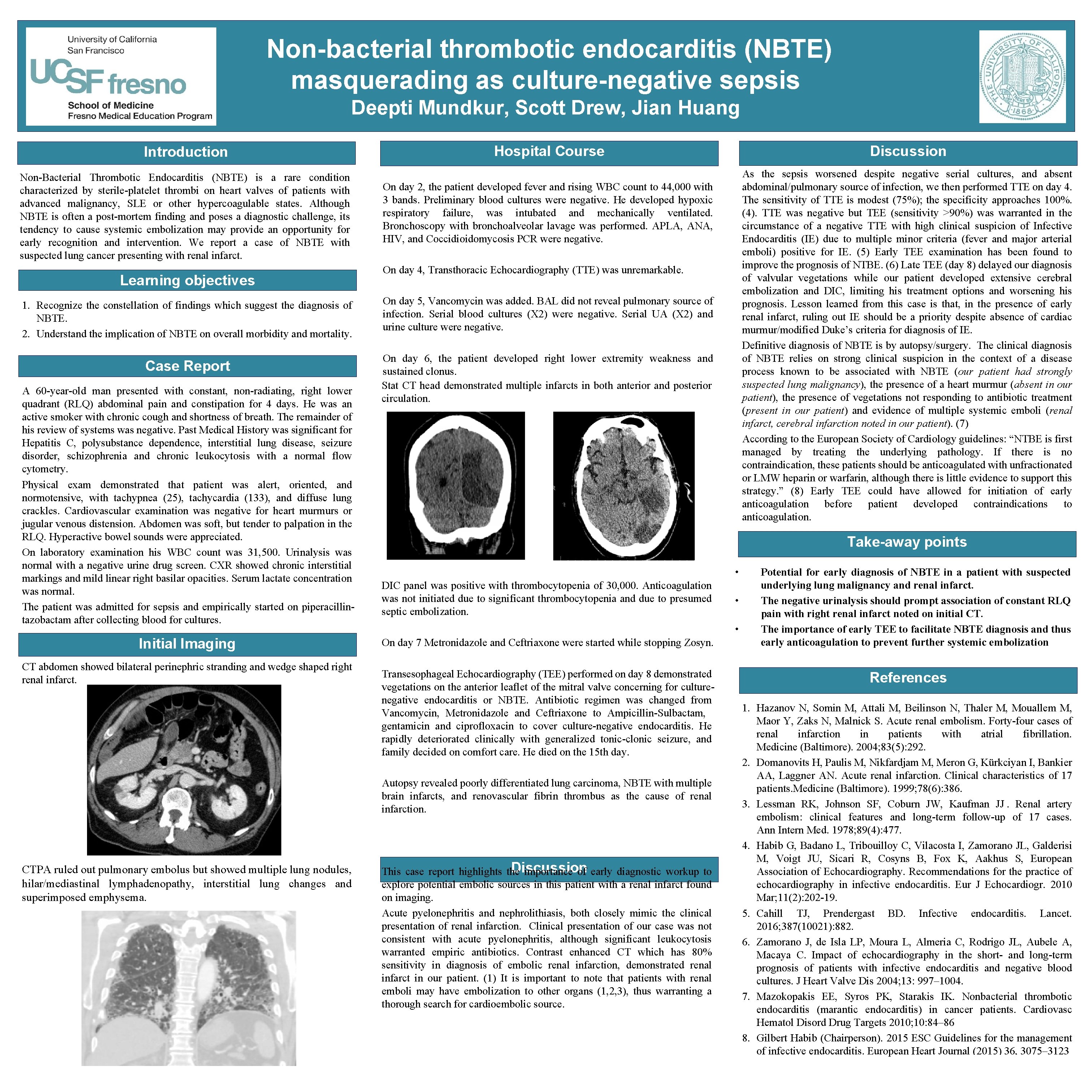 Non-bacterial thrombotic endocarditis (NBTE) masquerading as culture-negative sepsis Deepti Mundkur, Scott Drew, Jian Huang