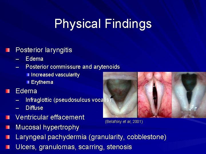 Physical Findings Posterior laryngitis – – Edema Posterior commissure and arytenoids Increased vascularity Erythema