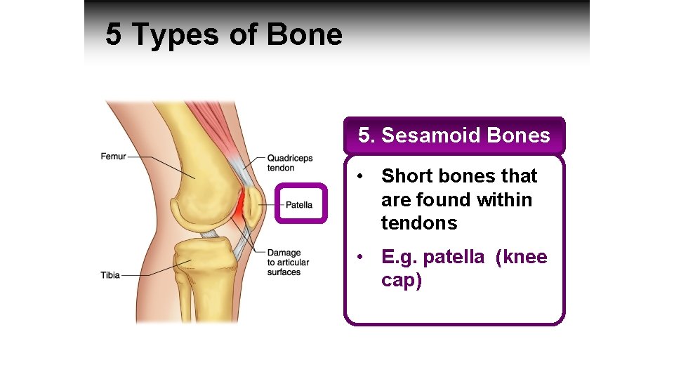 5 Types of Bone 5. Sesamoid Bones • Short bones that are found within