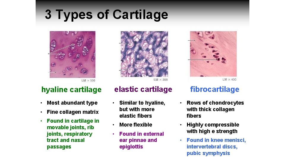 3 Types of Cartilage hyaline cartilage • Most abundant type • Fine collagen matrix