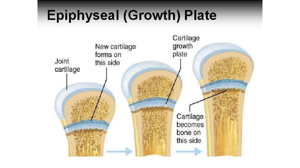 Epiphyseal (Growth) Plate 