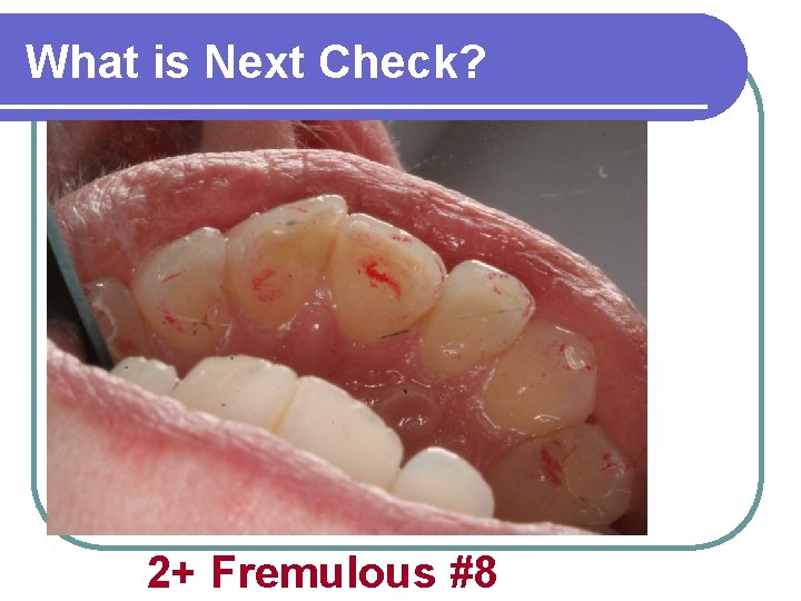 What is Next Check? 2+ Fremulous #8 