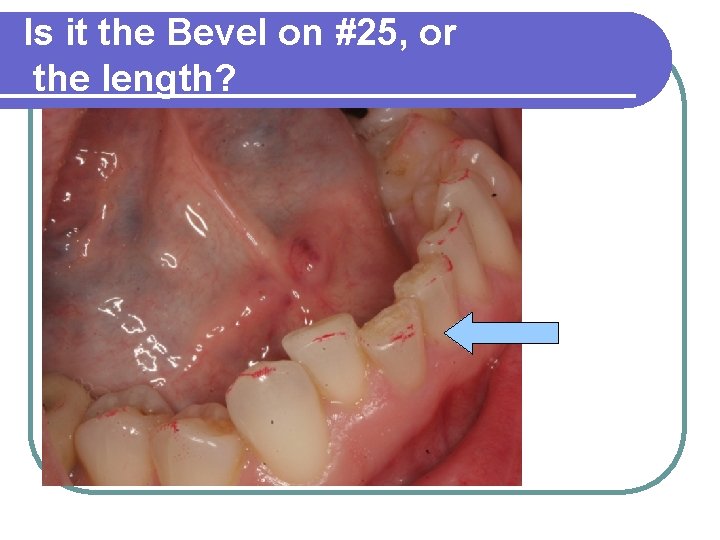 Is it the Bevel on #25, or the length? 