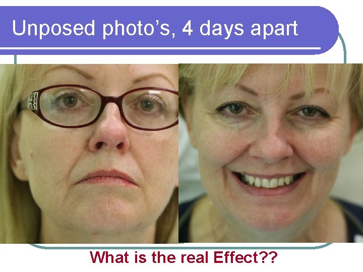 Unposed photo’s, 4 days apart What is the real Effect? ? 