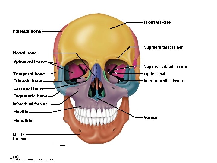 Frontal bone Parietal bone Supraorbital foramen Nasal bone Sphenoid bone Superior orbital fissure Temporal