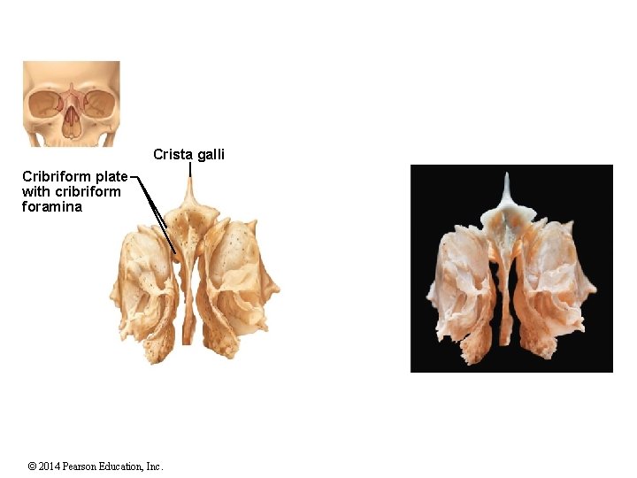 Crista galli Cribriform plate with cribriform foramina © 2014 Pearson Education, Inc. 