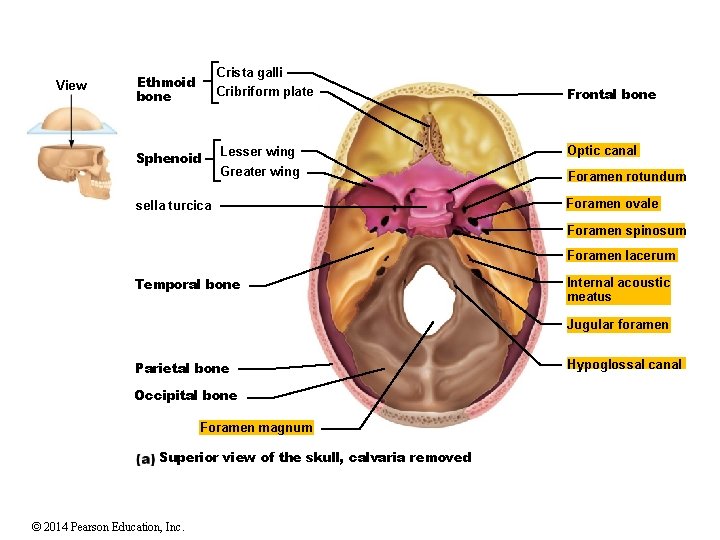 View Crista galli Cribriform plate Ethmoid bone Sphenoid Frontal bone Lesser wing Optic canal