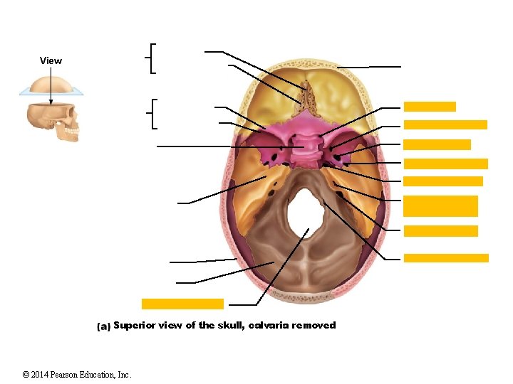 View Superior view of the skull, calvaria removed © 2014 Pearson Education, Inc. 