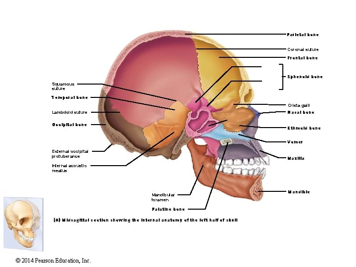 Parietal bone Coronal suture Frontal bone Sphenoid bone Squamous suture Temporal bone Crista galli