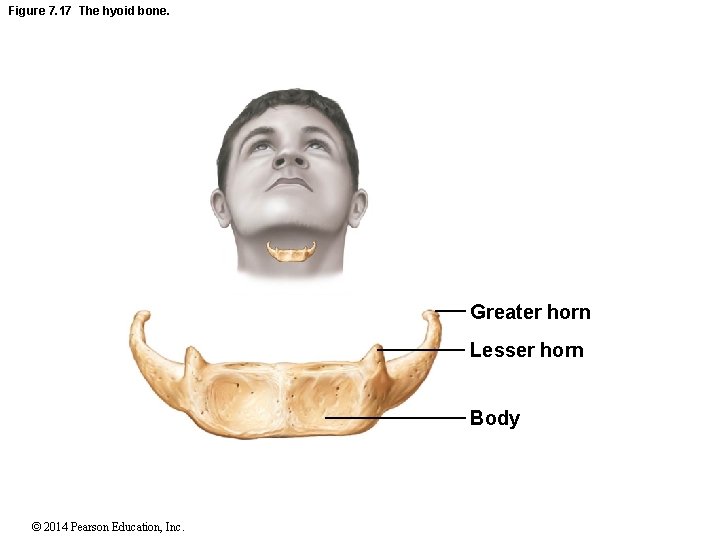 Figure 7. 17 The hyoid bone. Greater horn Lesser horn Body © 2014 Pearson