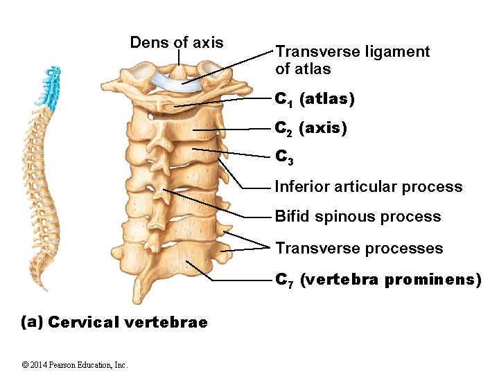 Dens of axis Transverse ligament of atlas C 1 (atlas) C 2 (axis) C