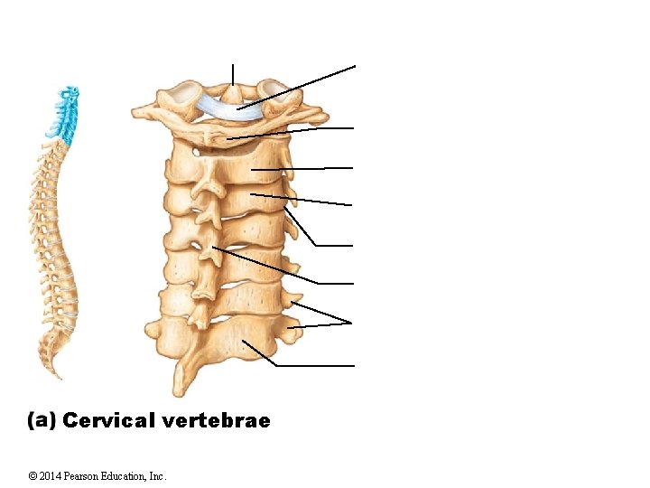 Cervical vertebrae © 2014 Pearson Education, Inc. 