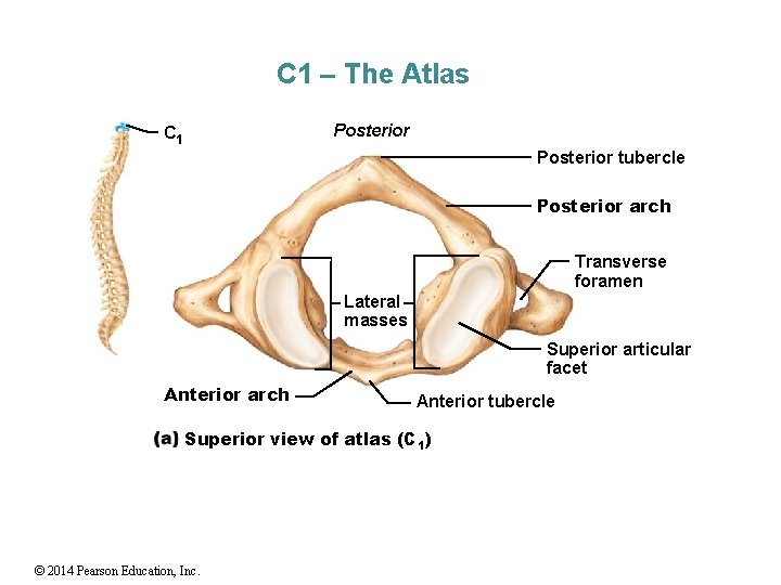 C 1 – The Atlas Posterior C 1 Posterior tubercle Posterior arch Transverse foramen