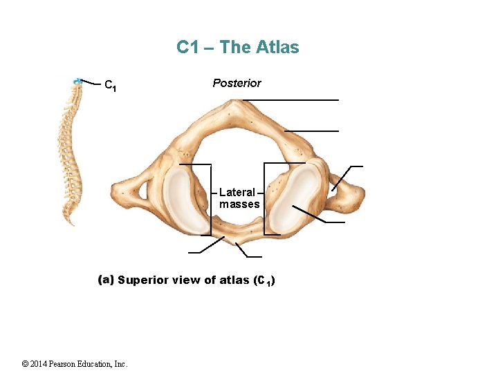 C 1 – The Atlas Posterior C 1 Lateral masses Superior view of atlas