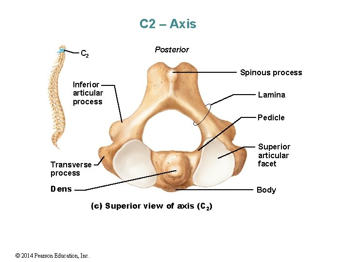 C 2 – Axis C 2 Posterior Spinous process Inferior articular process Lamina Pedicle