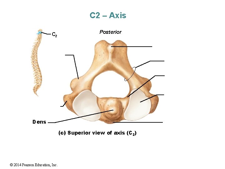 C 2 – Axis C 2 Posterior Dens Superior view of axis (C 2)