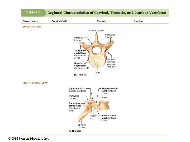 © 2014 Pearson Education, Inc. 
