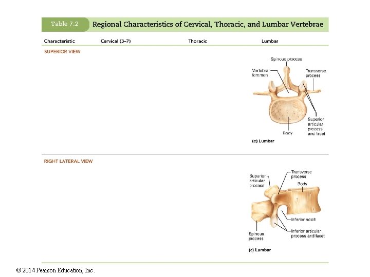 © 2014 Pearson Education, Inc. 