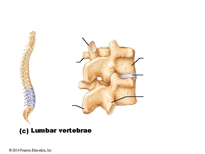 Lumbar vertebrae © 2014 Pearson Education, Inc. 