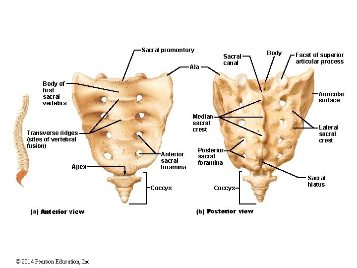 Sacral promontory Sacral canal Ala Body of first sacral vertebra Body Facet of superior