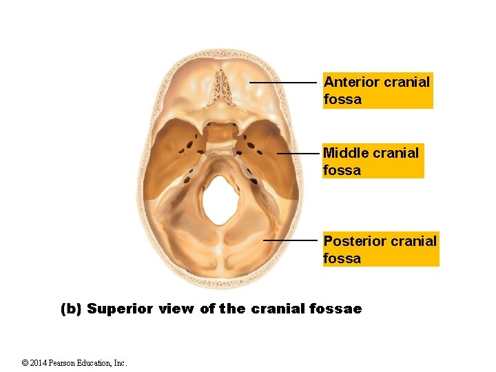 Anterior cranial fossa Middle cranial fossa Posterior cranial fossa Superior view of the cranial