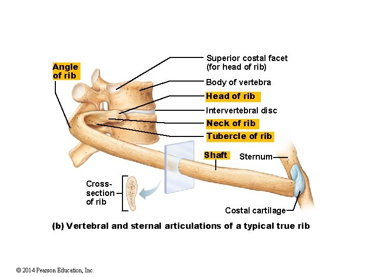 Superior costal facet (for head of rib) Angle of rib Body of vertebra Head
