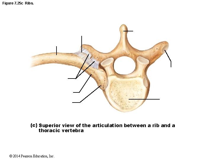 Figure 7. 25 c Ribs. Superior view of the articulation between a rib and