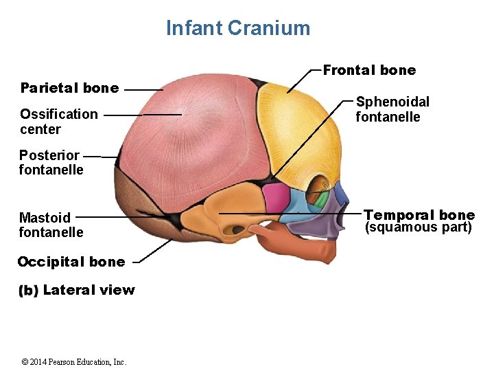Infant Cranium Parietal bone Ossification center Frontal bone Sphenoidal fontanelle Posterior fontanelle Mastoid fontanelle