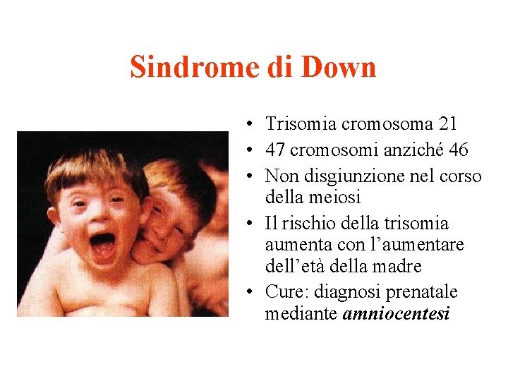 Sindrome di Down • Trisomia cromosoma 21 • 47 cromosomi anziché 46 • Non