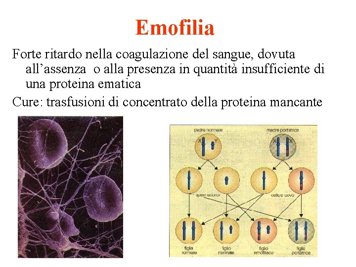 Emofilia Forte ritardo nella coagulazione del sangue, dovuta all’assenza o alla presenza in quantità
