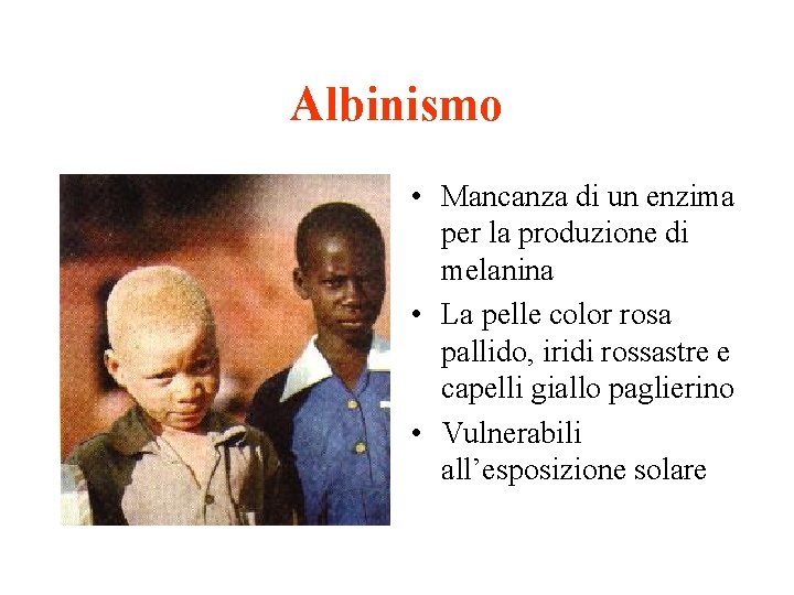 Albinismo • Mancanza di un enzima per la produzione di melanina • La pelle
