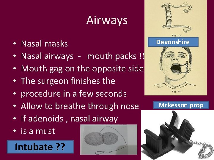 Airways • • Nasal masks Nasal airways - mouth packs !! Mouth gag on