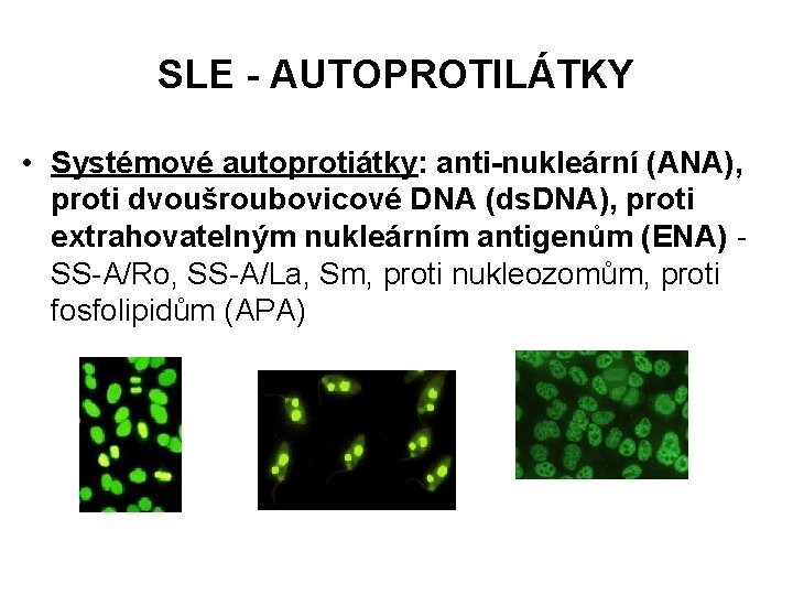 SLE - AUTOPROTILÁTKY • Systémové autoprotiátky: anti-nukleární (ANA), proti dvoušroubovicové DNA (ds. DNA), proti