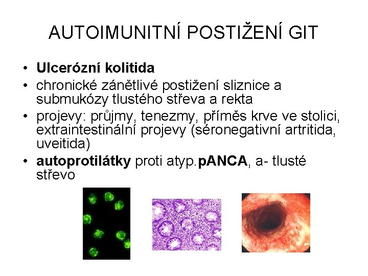 AUTOIMUNITNÍ POSTIŽENÍ GIT • Ulcerózní kolitida • chronické zánětlivé postižení sliznice a submukózy tlustého