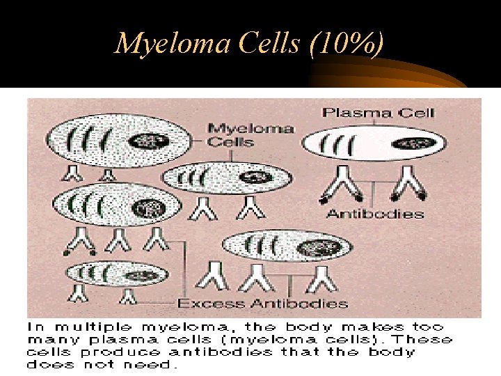 Myeloma Cells (10%) 