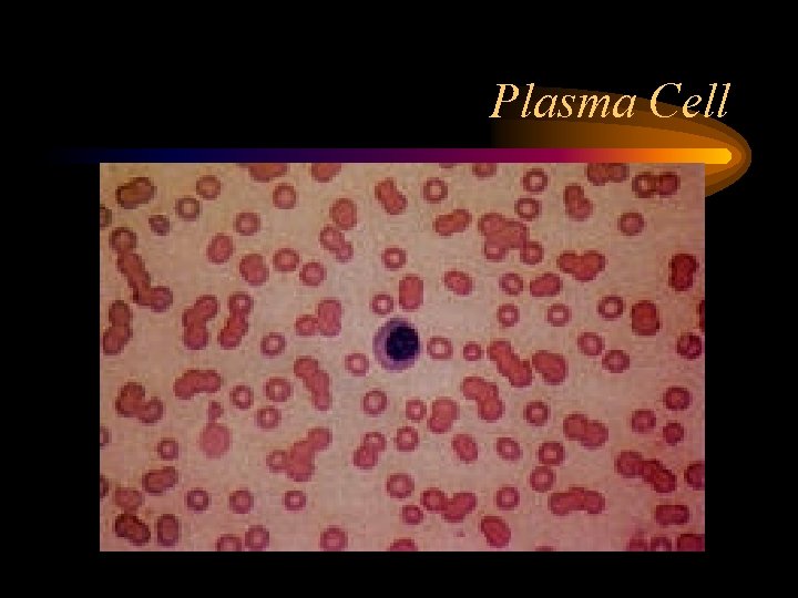 Plasma Cell 