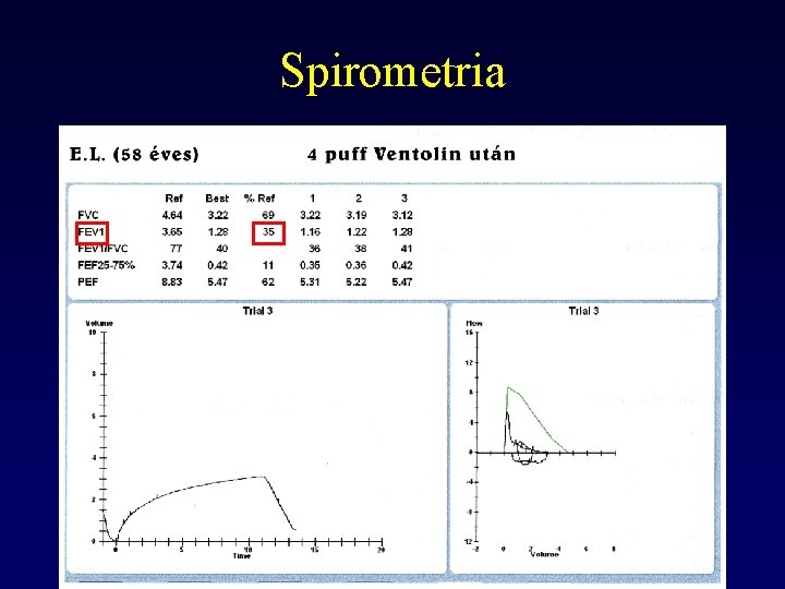 Spirometria 