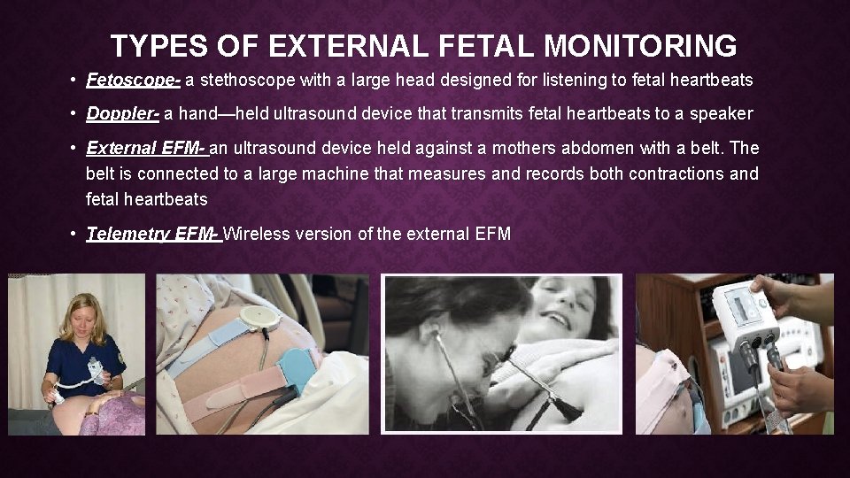TYPES OF EXTERNAL FETAL MONITORING • Fetoscope- a stethoscope with a large head designed