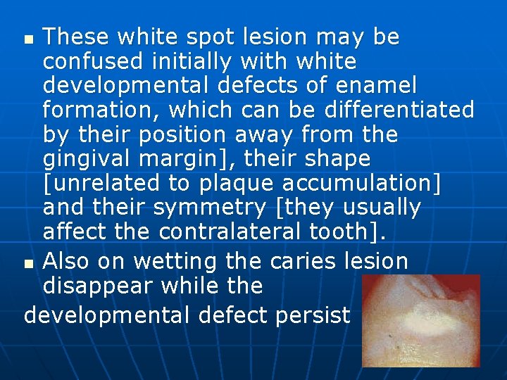 These white spot lesion may be confused initially with white developmental defects of enamel