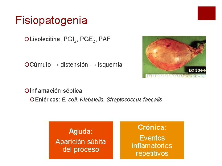 Fisiopatogenia ¡Lisolecitina, PGI 2, PGE 2, PAF ¡Cúmulo → distensión → isquemia ¡Inflamación séptica Fisiopatogenia ¡Lisolecitina, PGI 2, PGE 2, PAF ¡Cúmulo → distensión → isquemia ¡Inflamación séptica