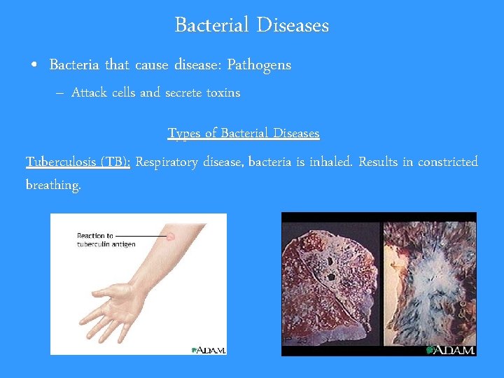 Bacterial Diseases • Bacteria that cause disease: Pathogens – Attack cells and secrete toxins