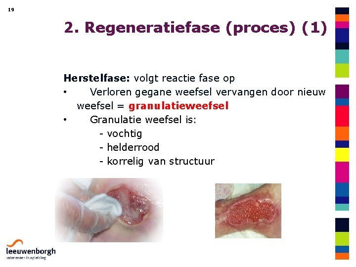 19 2. Regeneratiefase (proces) (1) Herstelfase: volgt reactie fase op • Verloren gegane weefsel